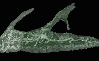 Picture showing CT scan of skull